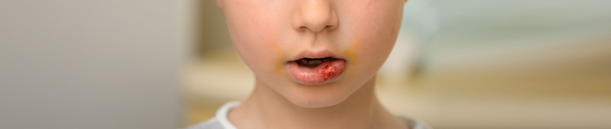 What to do if your child knocks his tooth off?